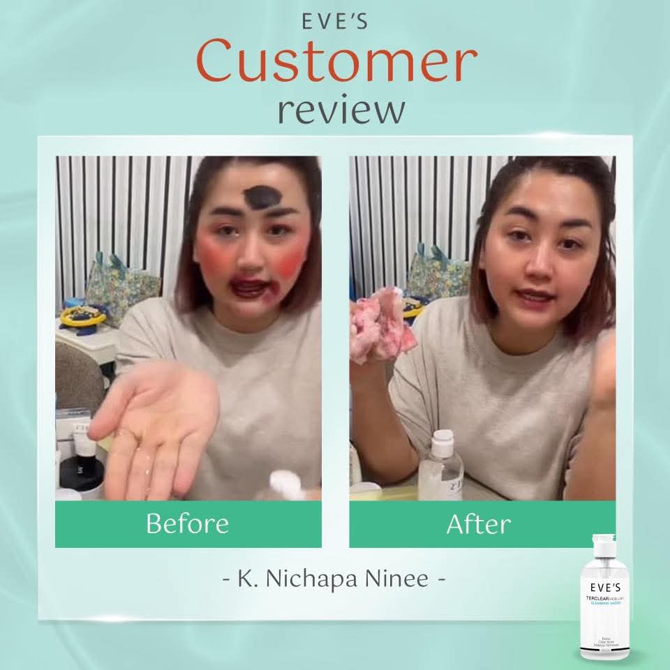 ✨หน้าใสไร้สิว ผิวแข็งแรง ไม่แพ้ง่าย✨
เผยผิวสุขภาพดีได้ทุกวัน ด้วยสกินแคร์รูทีน
ครบทุกขั้นตอน ตั้งแต่คลีนผิวจนถึงกันแดด