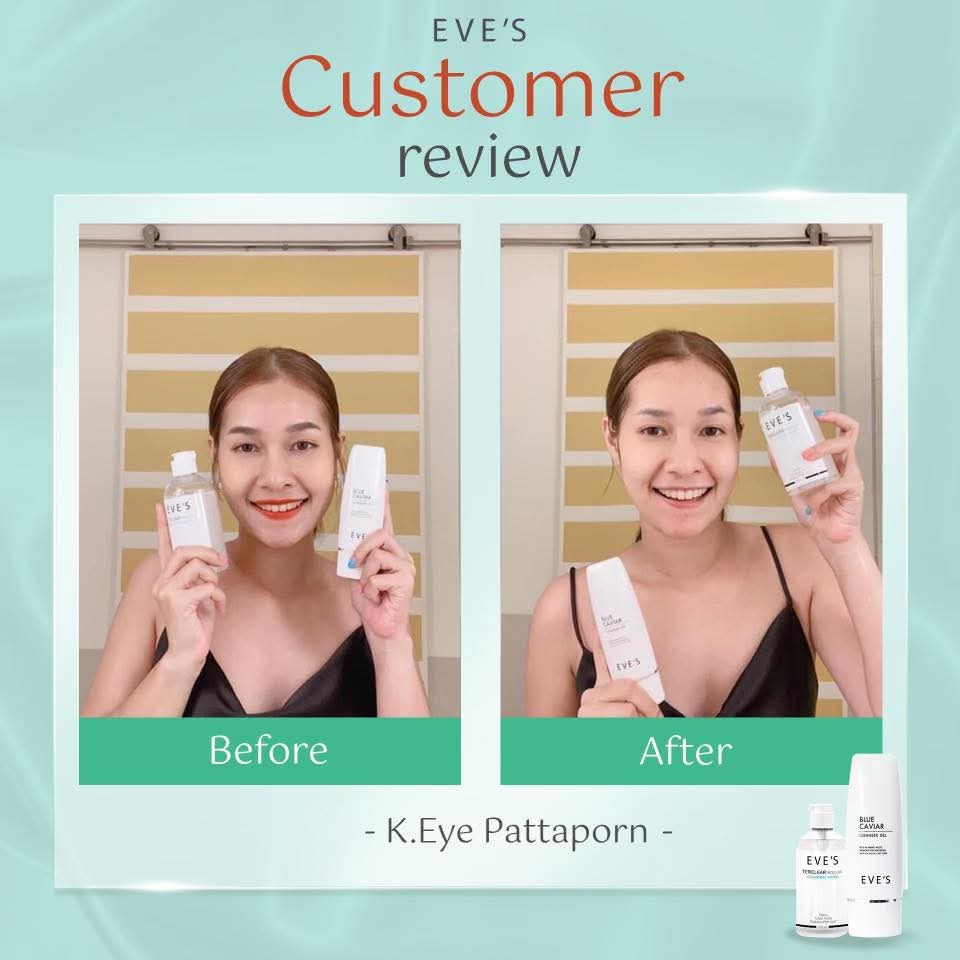 ✨หน้าใสไร้สิว ผิวแข็งแรง ไม่แพ้ง่าย✨
เผยผิวสุขภาพดีได้ทุกวัน ด้วยสกินแคร์รูทีน
ครบทุกขั้นตอน ตั้งแต่คลีนผิวจนถึงกันแดด