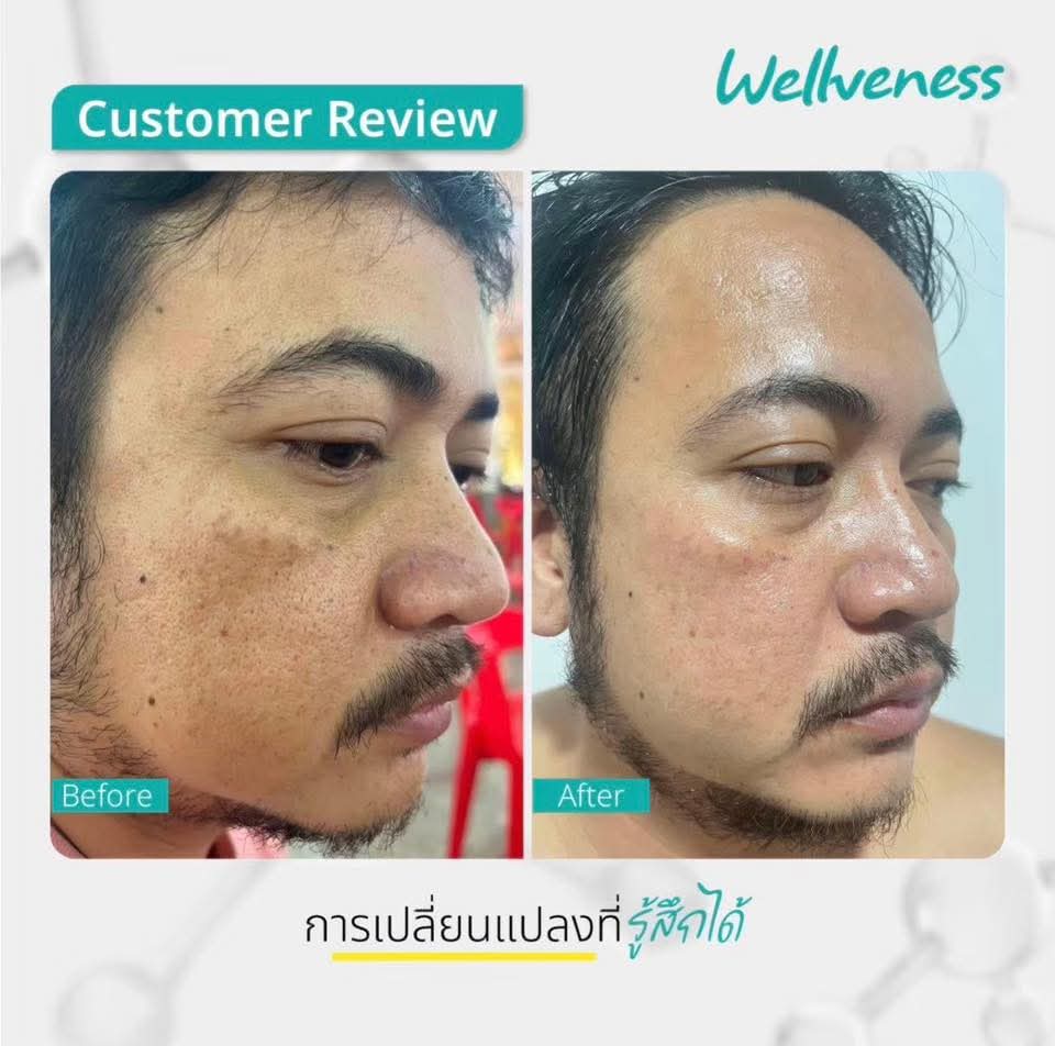 CERABRIGHT- เซราไบรท์ CUCUMIS CERABRIGHT BARRIER SESUM IN CREAM คูคูมิส เซราไบร์ท แบริเอร์ เซรั่ม อิน ครีม
