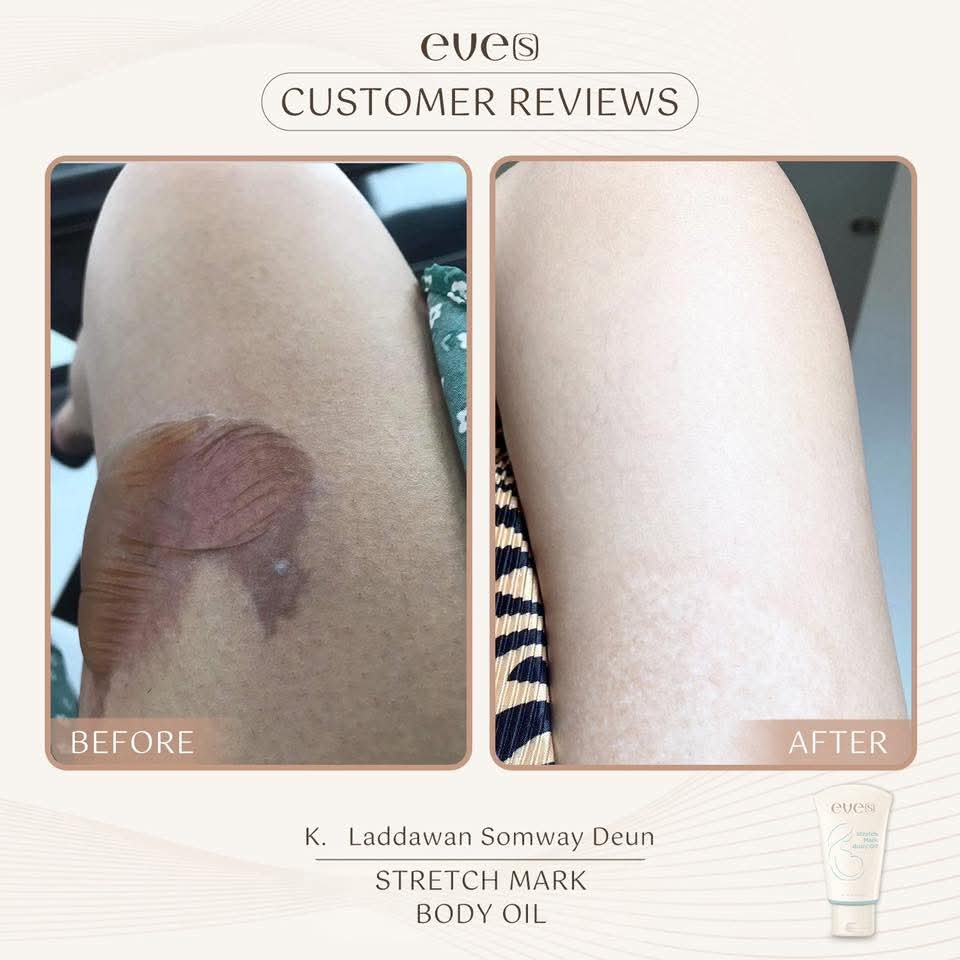 ชุดบำรุงผิวคุณแม่ 1 - 1 อีฟส์ออย / 2 บูสเตอร์ฟ้า