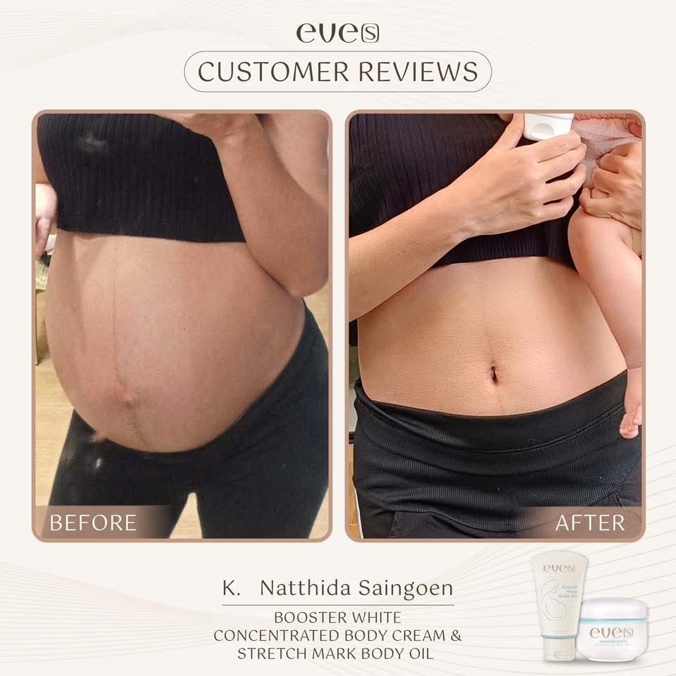 ชุดบำรุงผิวคุณแม่ 1 - 1 อีฟส์ออย / 2 บูสเตอร์ฟ้า