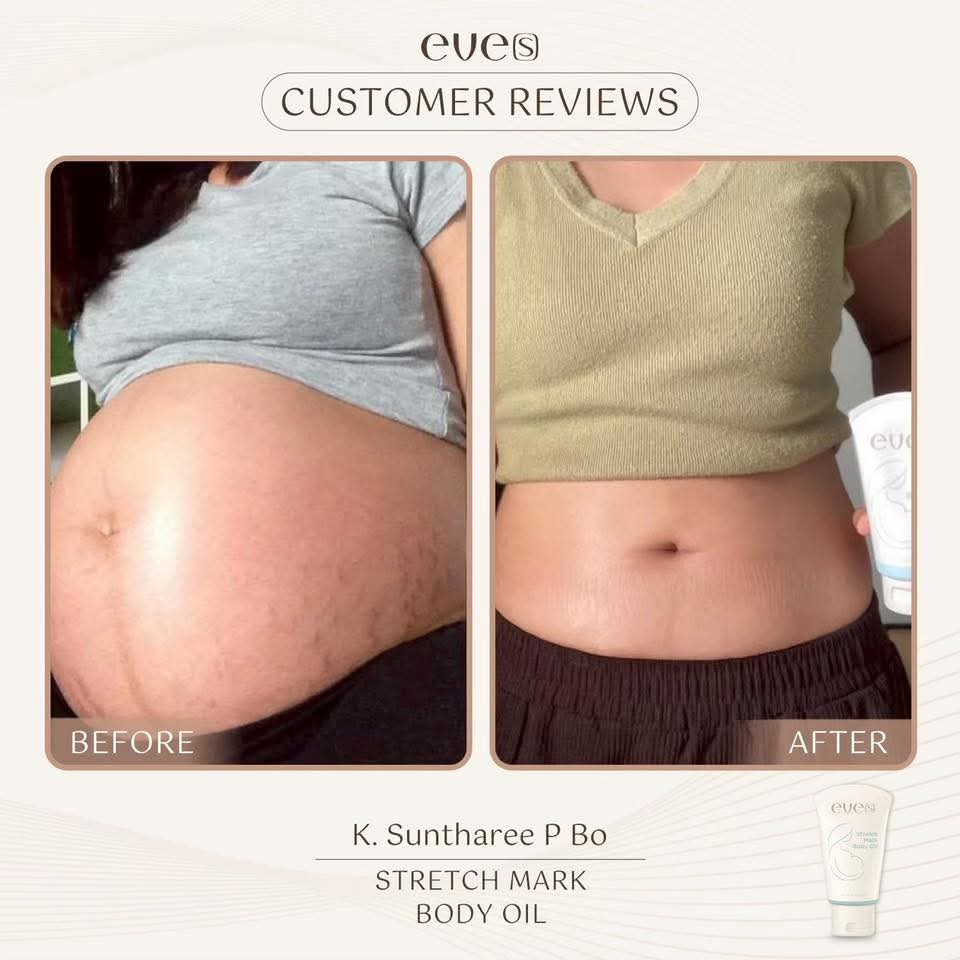 ชุดบำรุงผิวคุณแม่ 1 - 1 อีฟส์ออย / 2 บูสเตอร์ฟ้า