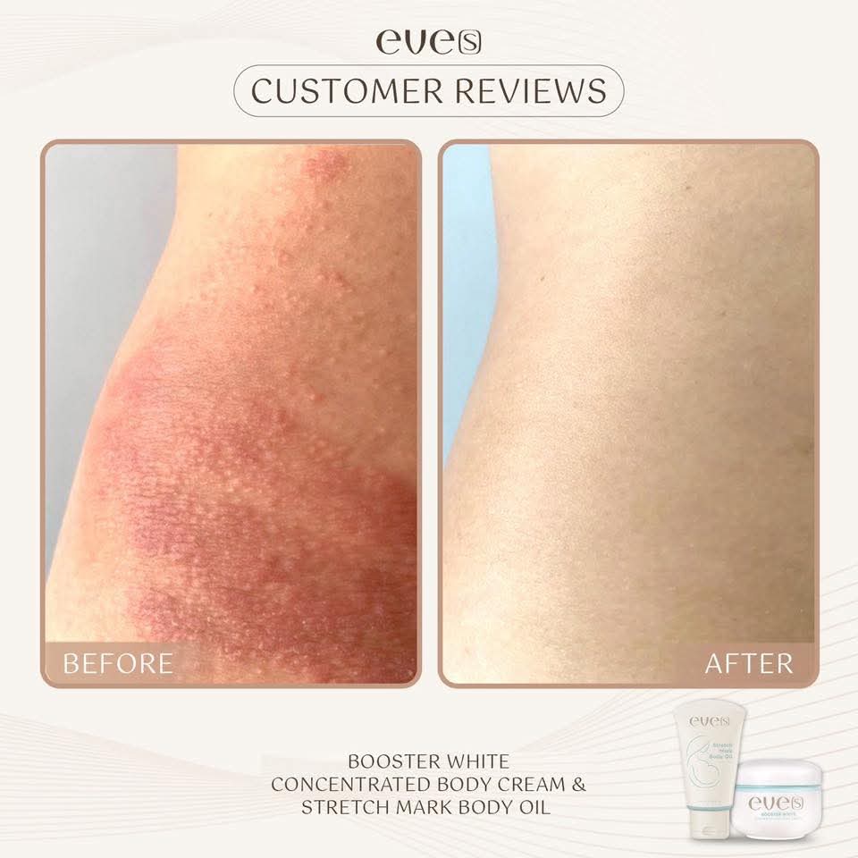 ชุดบำรุงผิวคุณแม่ 1 - 1 อีฟส์ออย / 2 บูสเตอร์ฟ้า