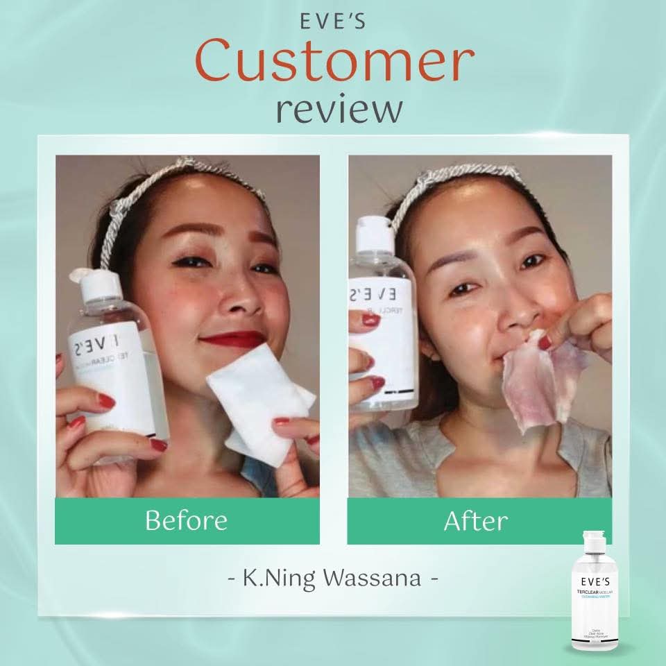 ✨หน้าใสไร้สิว ผิวแข็งแรง ไม่แพ้ง่าย✨
เผยผิวสุขภาพดีได้ทุกวัน ด้วยสกินแคร์รูทีน
ครบทุกขั้นตอน ตั้งแต่คลีนผิวจนถึงกันแดด