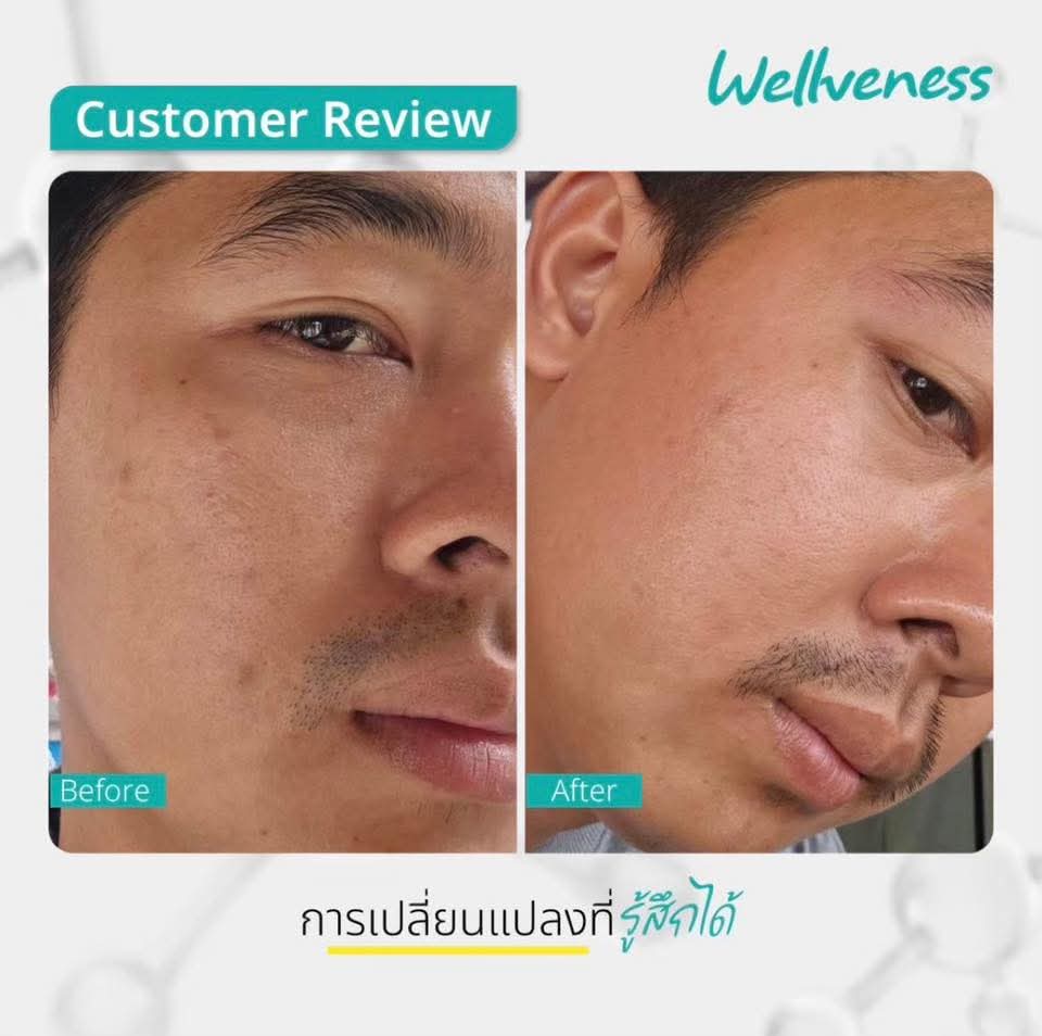 CERABRIGHT- เซราไบรท์ CUCUMIS CERABRIGHT BARRIER SESUM IN CREAM คูคูมิส เซราไบร์ท แบริเอร์ เซรั่ม อิน ครีม